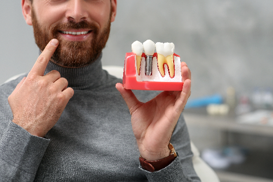 The Life-Changing Benefits of Dental Implants with Smileology