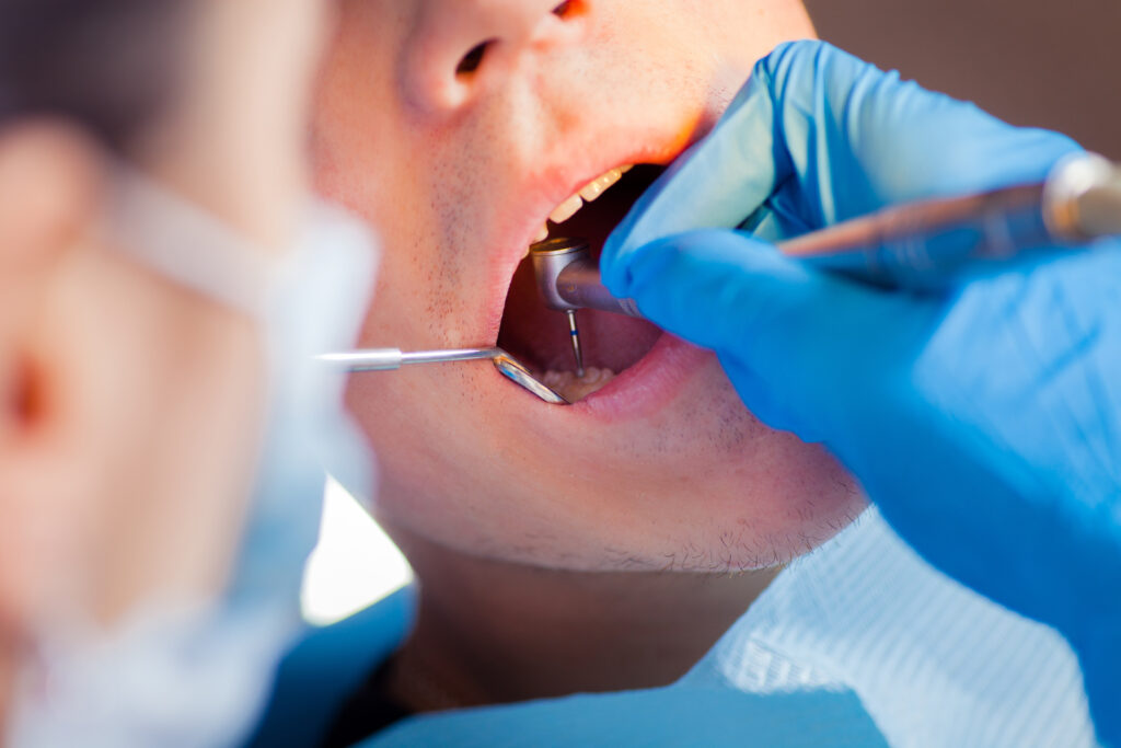 dentist examining a patients tooth that may need to be extracted
