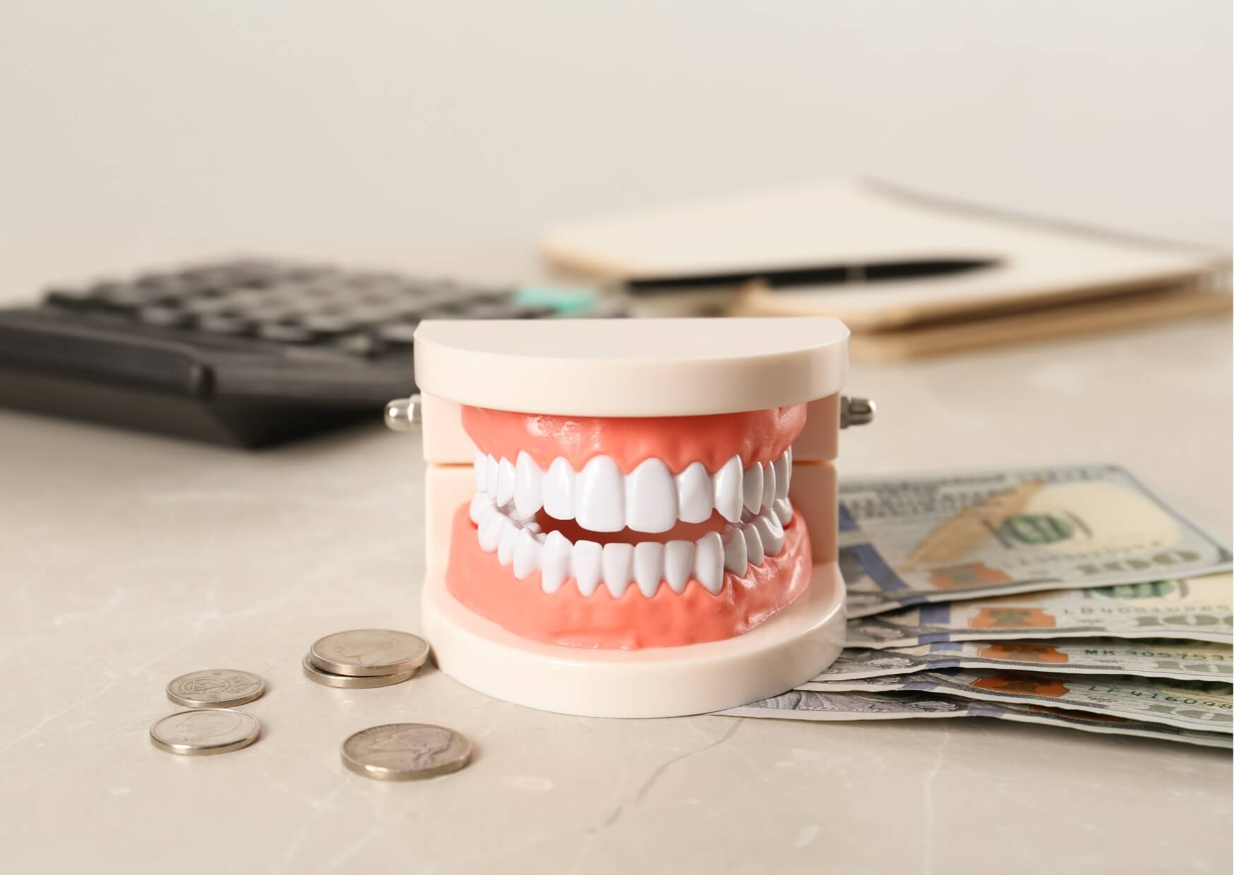 Dental model with cash and a calculator, illustrating how veneer costs can vary by location and dental practice.
