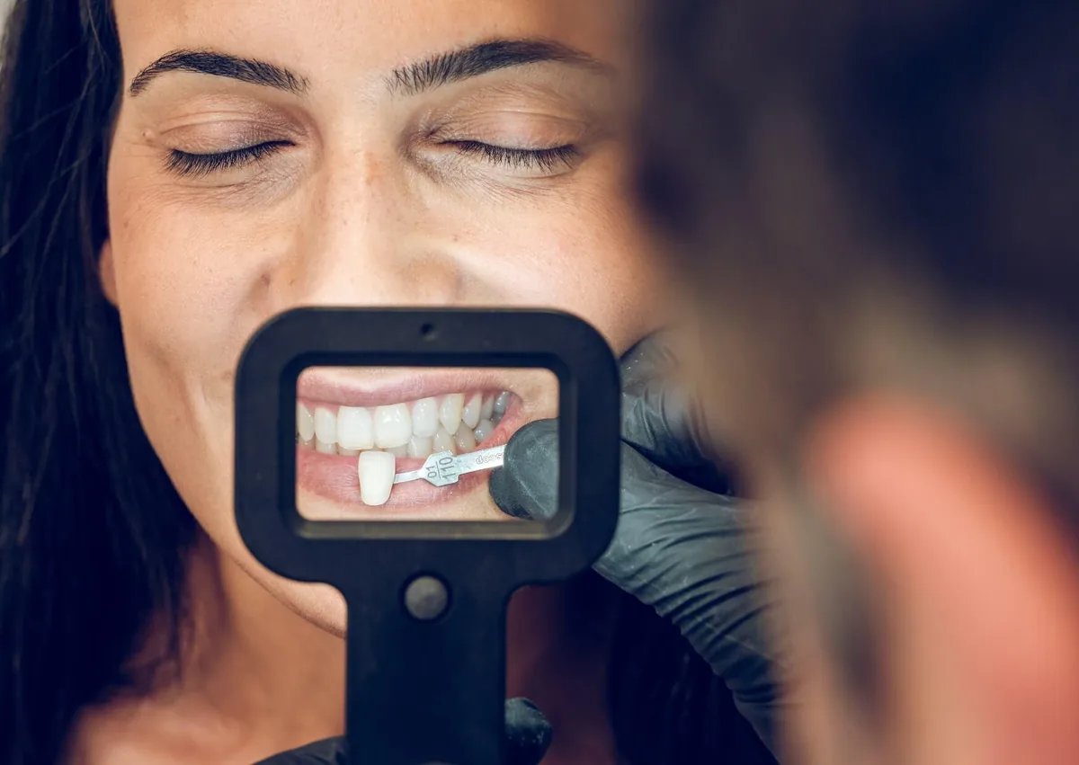 Dentist matching tooth shade as part of a personalized smile makeover treatment.
